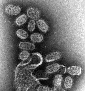 EM_of_influenza_virus_small.jpg